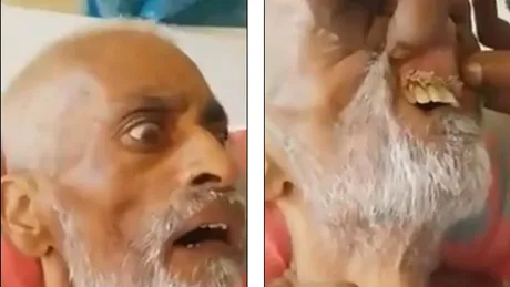Fiul unui pacient a gasit viermi in interiorul gurii tatalui sau in timp ce era tratat in spital VIDEO