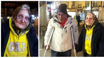 Batrana aceasta a fost desfigurata in urma unui atac rasist. Traieste din cersit si doarme pe strazi VIDEO