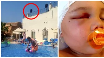 O boxa mare a cazut de la balconul unui hotel in capul unui copil de 3 ani! Ce rani a suferit si de ce va fi despagubit la 18 ani