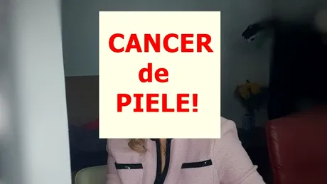 O celebră actriță de la noi s-a luptat din nou cu cancerul! A trecut print-o operație complicată chiar de ziua ei