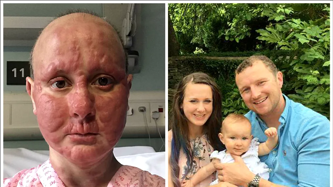 Cutremurator! Femeia distrusa de cancer la doar 34 de ani. In ce hal arata fata ei si de ce nu-i mai lasa pe copii sa o vada inainte de moarte