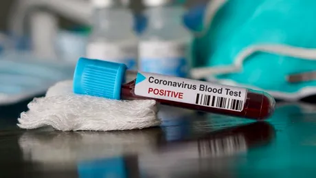 Bilanț coronavirus România. 1271 de noi cazuri în ultimele 24 de ore