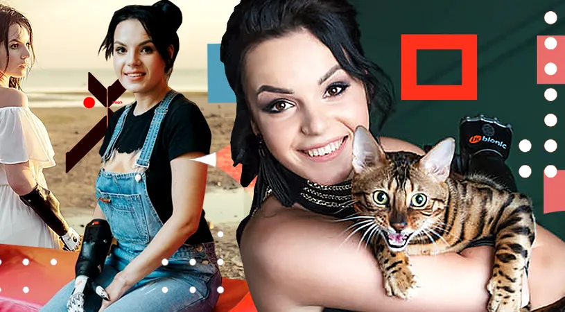 VIDEO. Povestea Margaritei, femeia mutilată pe viață la doar 26 de ani. Soțul gelos i-a tăiat mâinile cu toporul