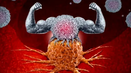 Imunoterapia, un nou tratament împotriva cancerului colorectal. Ce spun specialiștii
