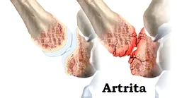 Galerie foto - Poza #4