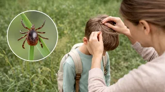 Cum ferim copiii de căpușe. Sfaturi simple care pot preveni probleme grave