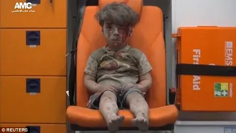 Cum arata baiatul care a devenit simbolul copiilor victime ale razboiului din Siria! Acum are 5 ani