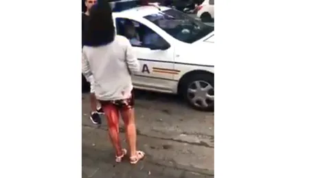 O fata plina de sange pe trup a fost ignorata de politisti. Oamenii legii nu au vrut sa coboare din masina VIDEO