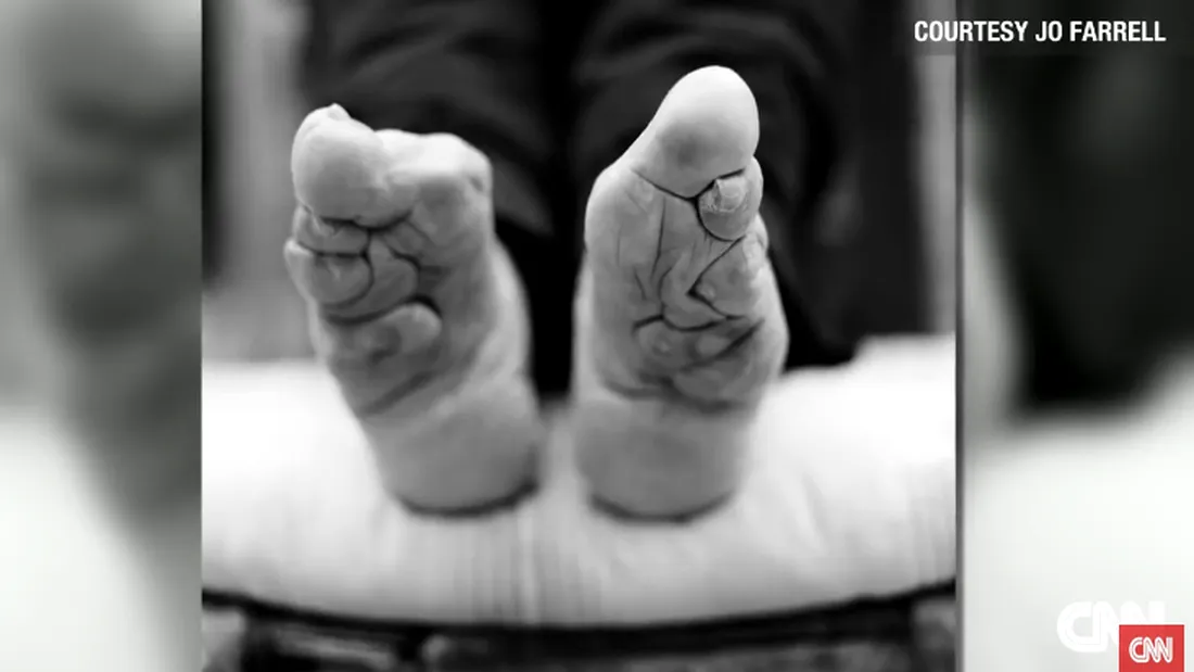 Imagini DURE cu atrocitatile la care erau supuse fetitele din China! Le erau rupte degetele de la picioare si...