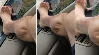 Barbatul asta si-a filmat piciorul in timpul unor crampe TERIFIANTE! Imaginile au ingrozit Internetul! VIDEO