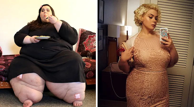 Cele mai spectaculoase transformari! Obezii de aproape 300 de kilograme care au slabit enorm iar acum sunt de nerecunoscut