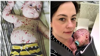 Bebelusul asta arata asa, dupa ce la nastere medicii nu-i dadeau nicio sansa! Ce s-a intamplat cu el si de ce toti il considera un miracol?!