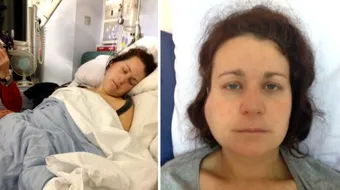 Aceasta femeie sufera de cea mai bizara boala! In fiecare dimineata se trezeste MAHMURA desi nu pune gura deloc pe alcool. Care e explicatia medicilor