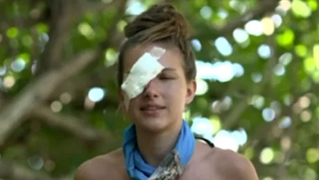 Alexandra Ciomag, cu ochiul bandajat la Survivor All Stars. Ce a pățit Războinica, înainte ca Elena Ionescu să fie eliminată
