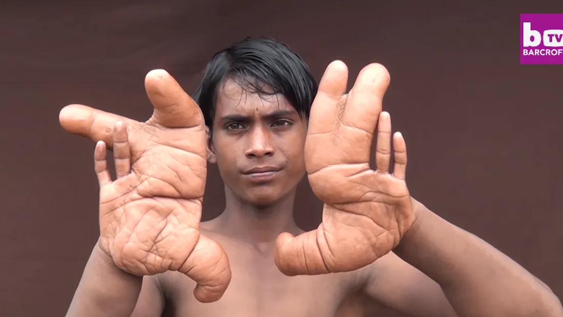 El e baiatul cu cele mai mari maini din lume! La 12 ani, membrele lui masoara 30 de cm! VIDEO