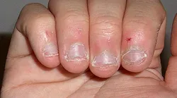 Galerie foto - Poza #4