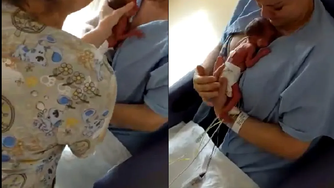 Moment emotionant cu mamica asta care isi tine pentru prima data la piept bebelusul nascut prematur! A izbucnit in plans VIDEO