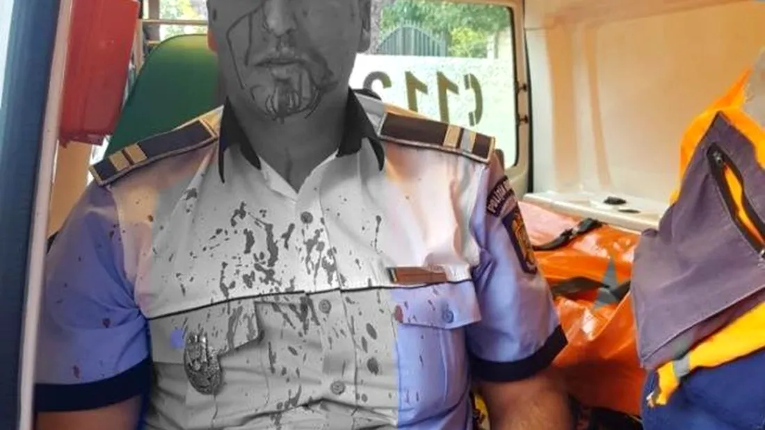 Imagini dramatice! Un politist din Craiova plin de sange dupa ce a fost rupt in bataie de un sofer! Agentul a tras 5 focuri de arma, dar agresorul tot a fugit!