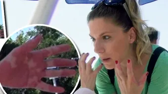 Tily Niculae, probleme de sanatate din cauza psoriazisului. Ce a patit vedeta VIDEO