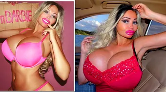 A investit 40.000 de dolari pentru a arata ca o papusa Barbie! Cat de frumoasa era tanara inainte de operatiile estetice! Diferenta e SOCANTA!