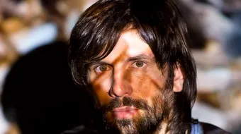 DJ Pagal a iesit din coma. Care e starea de sanatate a cantaretului dupa accident. A ramas fara dinti