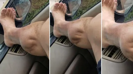 Barbatul asta si-a filmat piciorul in timpul unor crampe TERIFIANTE! Imaginile au ingrozit Internetul! VIDEO
