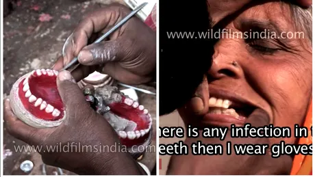 Cum arata dentistii din India?! Stau pe marginea drumului, scot dintii pacientilor si tot acolo pun altii la loc pe care ii fac... in cateva minute VIDEO