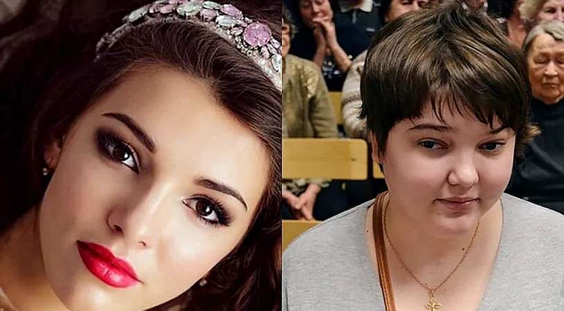Nu-ti vine sa crezi ca e una si aceeasi persoana! Tanara asta superba a ajuns sa arate asa din cauza iubitului! Ce i-a facut barbatul de a ajuns in asemenea hal
