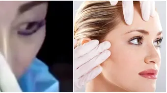 A incercat sa scape de riduri, dar rezultatul e infricosator! Ce si-a facut femeia la fata in doar cateva secunde intrece orice imaginatie VIDEO