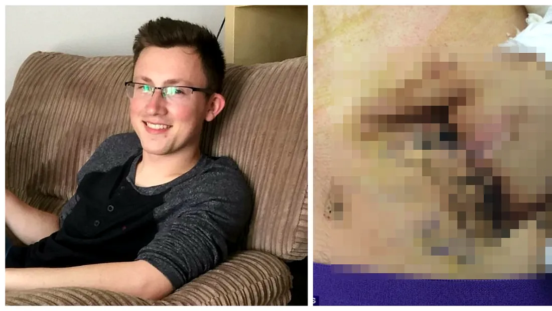 Pompierul care a stat cu mana in burta timp de 3 saptamani. Medicii i-au facut un buzunar si au cusut-o acolo. De ce