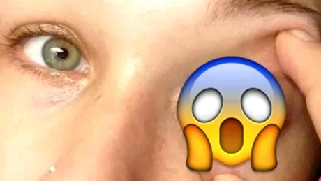 Nu a simtit nicio durere cand a mers sa isi faca un tatuaj in ochi! Insa dupa ce s-a intors acasa si s-a uitat in oglinda, a inlemnit! Ce i-a iesit VIDEO