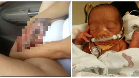 Gravida in 29 de saptamani, a intrat in travaliu. A ignorat contractiile, dar tot la spital a ajuns. Ce s-a intamplat