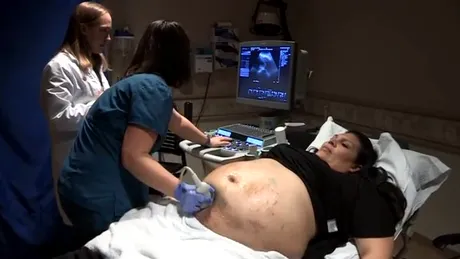 Burtica ei de gravida era plina de vanatai. Ce au descoperit doctorii cand i-au facut ecografie VIDEO
