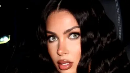 Influencerița celebră care a vrut să arate ca „Barbie” și a fost la un pas de moarte. Implantul din fesieri i-a explodat! Cât s-a chinuit bruneta