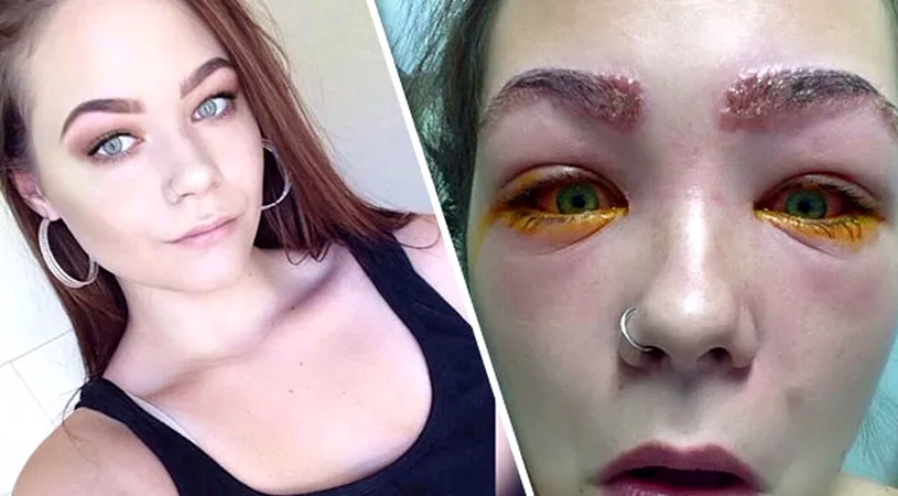 A fost la un pas de orbire din cauza unui produs cosmetic. Drama prin care trece tanara aceasta FOTO