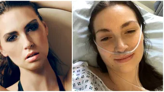 Tanara asta e fotomodel, dar sufera de o boala atat de rara incat nici medicii n-au auzit de asa ceva! E cumplit prin ce trece! Nu a mai urinat de doi ani