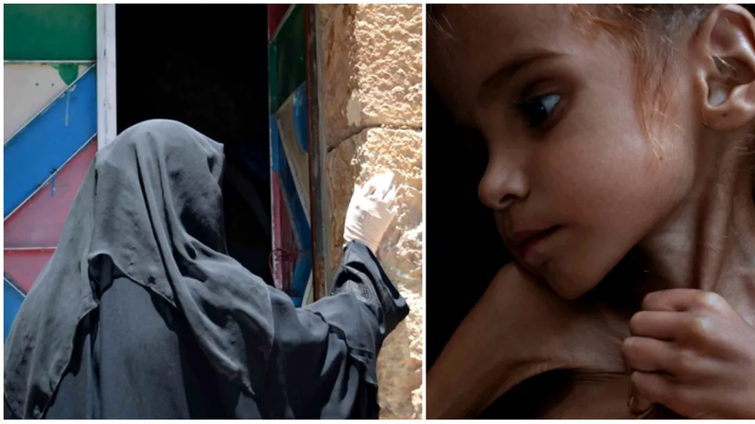 A murit fetita de 7 ani care a impresionat intreaga planeta pana la lacrimi! Devenise simbolul crizei din Yemen si era doar piele si os
