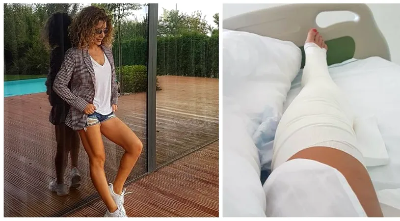 Carmen Bruma si-a operat picioarele. Vedeta avea varice VIDEO