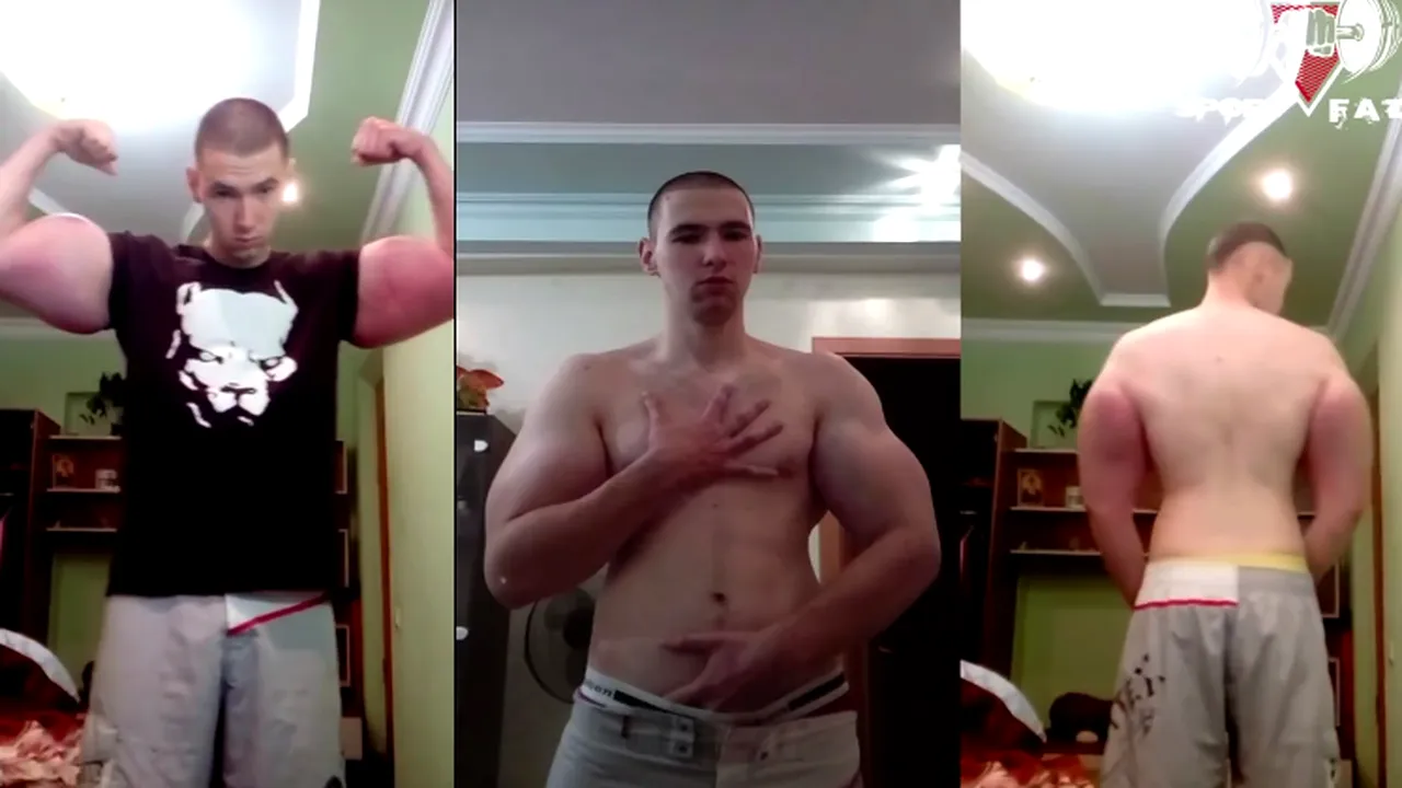 body builder si-a injectat ulei in muschi 4 