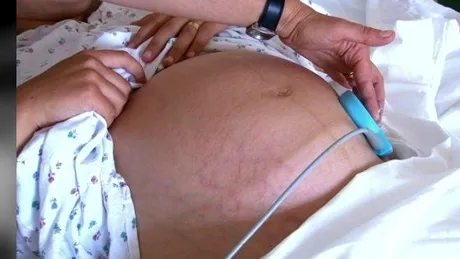 Mamă în stare gravă după ce i s-a scos uterul. Medicul nu a operat-o fiindcă anestezistul nu lucrează după-amiaza
