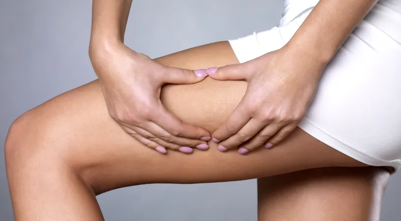 Scapă de celulita localizată inestetic în cel mai simplu mod!
