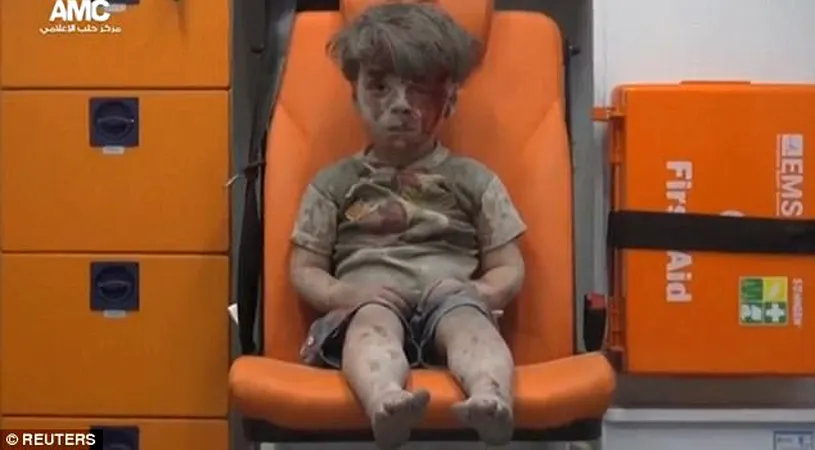 Cum arata baiatul care a devenit simbolul copiilor victime ale razboiului din Siria! Acum are 5 ani