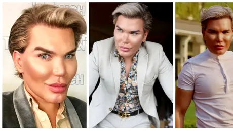 Medicii refuza sa-l mai opereze pe barbatul care s-a transformat in papusa Ken! Ce diagnostic crunt a primit din partea doctorilor, dupa 57 de operatii. E devastat