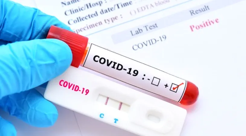 România produce primul test rapid de depistare a virusului SARS COV 2. Cum funcționează