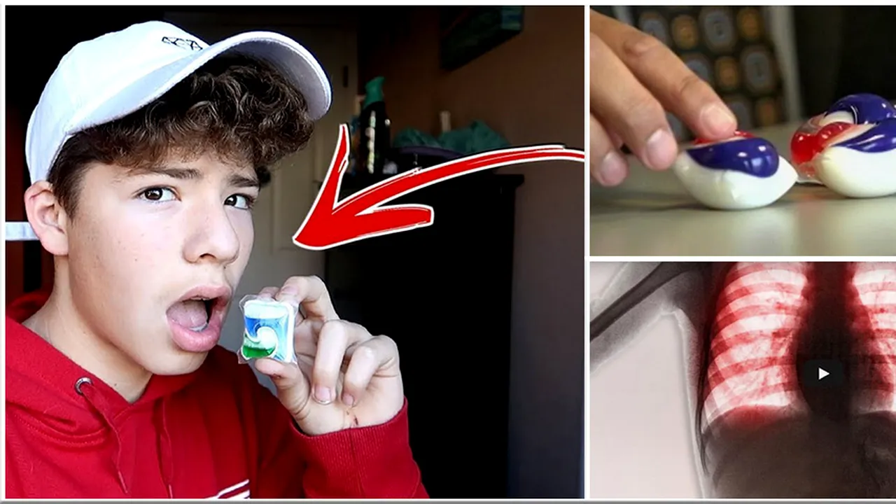 Un tanar a mancat 3 capsule de detergent. Ce s-a intamplat 