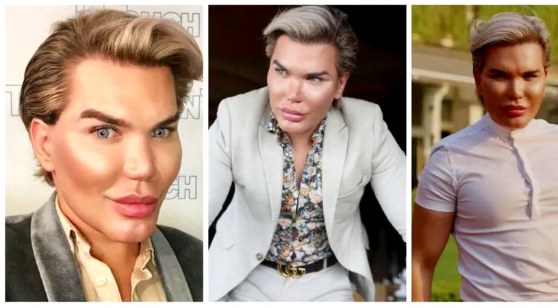 Medicii refuza sa-l mai opereze pe barbatul care s-a transformat in papusa Ken! Ce diagnostic crunt a primit din partea doctorilor, dupa 57 de operatii. E devastat