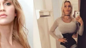 Şi-a scos 6 coaste pentru a arăta ca Femeia Fantastică, dar au măcelărit-o! Cum arată acum