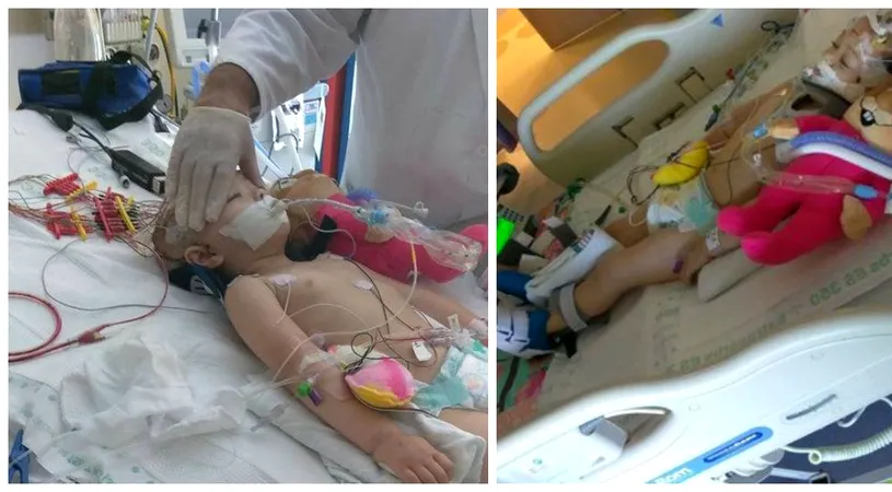 Doamne, cata cruzime! Aceasta micuta a fost desfigurata de cel care trebuia sa aiba grija de ea! Fetita a fost deja operata la cap