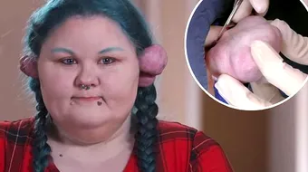 Si-a dat gauri in ureche si i-au CRESCUT! Ce a patit aceasta femeie e ingrozitor! VIDEO