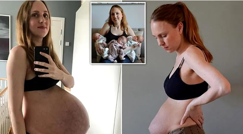 Cum arata mama asta dupa o sarcina cu tripleti! A avut curaj sa-si faca poze la abdomen si inainte dar si dupa ce a nascut! Toate femeile o apreciaza si o felicita!